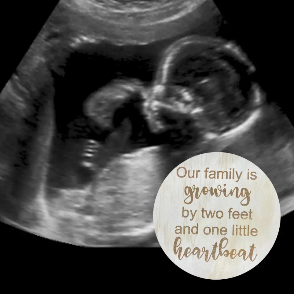 Pregnancy announcement set - All Things Baby